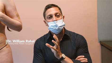 bbl trans|3 Month Follow Up, Transgender Patient 360 Liposuction, BBL.